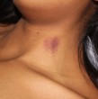 Revisa qué dicen los expertos sobre la posibilidad de que una persona pueda morir por un chupetón o chupón en el cuello. Esta es una curiosidad que le ha ocurrido a algunas personas en el mundo.