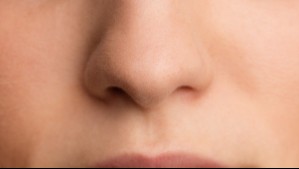 Cáncer de nariz: Estos son 5 síntomas comunes de la enfermedad