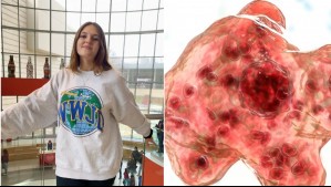 Joven estudiante muere tras contraer una ameba comecerebros en lago de Estados Unidos