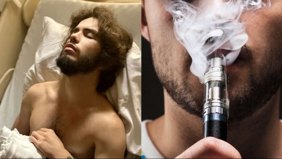 Fue algo aterrador": Joven muestra impresionante dao en sus pulmones tras  usar vaporizador durante cinco aos - Meganoticias