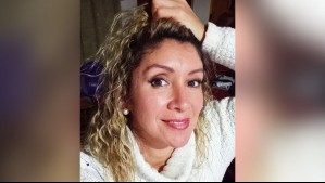 Está perdiendo el cabello: Esta es la enfermedad que padece Angélica Sepúlveda