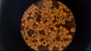 Ya hay un caso en Chile: Cómo identificar el hongo de la Sporothrix Brasiliensis