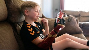 'La gente ha dicho lo genial que es': Niño que nació sin su mano derecha ahora tiene un brazo biónico de Iron Man