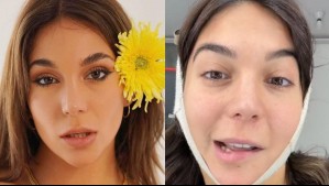 'La gente me está haciendo mucho bullying': Influencer quedó con parálisis facial tras realizarse una segunda lipopapada