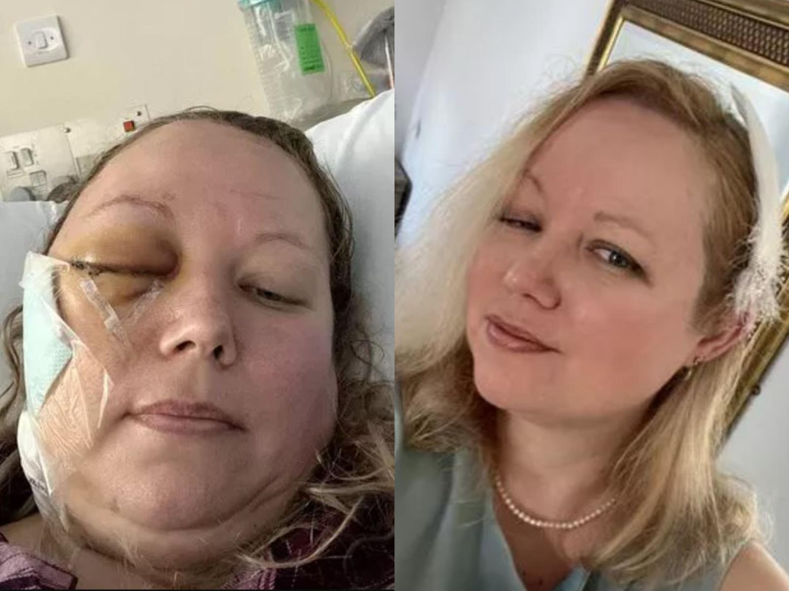 Ciaran 6 días después de la cirugía / Ciara en recuperación (SWNS)