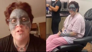 La historia de la cumpleañera que fue a celebrar con su pareja y despertó con la cara tatuada con obscenidades