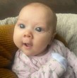 Los grandes ojos azules de una bebé de Inglaterra en realidad eran el síntoma de una grave enfermedad. Aretria, de 10 meses, tiene glaucoma y perdió la visión de un ojo. Conoce su historia.