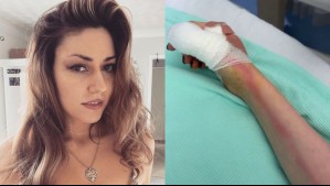Fue a jugar bolos y casi muere: Mujer sufrió una herida en el dedo y terminó con grave infección en la sangre