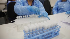 Laboratorio Sanderson asevera que 'no existe prueba concreta' de contaminación microbiológica de sus productos