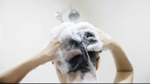 Dermatólogo explica qué tan seguido hay que lavarse el cabello