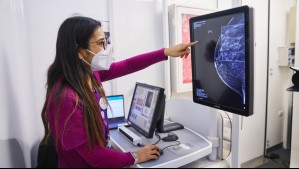 #AltoAlCáncer: Centros comerciales de Cencosud realizarán 1.500 mamografías gratuitas