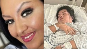 Se intervino los labios con esteticista que encontró en Instagram y murió dos semanas después: 'No pudimos hacer nada'