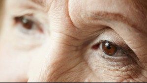 Cataratas: Estos son los síntomas que advierten sobre la pérdida de la visión