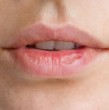 Revisa cuáles son las enfermedades que pueden verse reflejadas en los labios, causando sequedad y llagas. La queilitis labial, como se le conoce en el mundo de la medicina, puede ser bastante dolorosa.