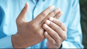 Estos son los primeros síntomas que te pueden advertir de que tienes artritis