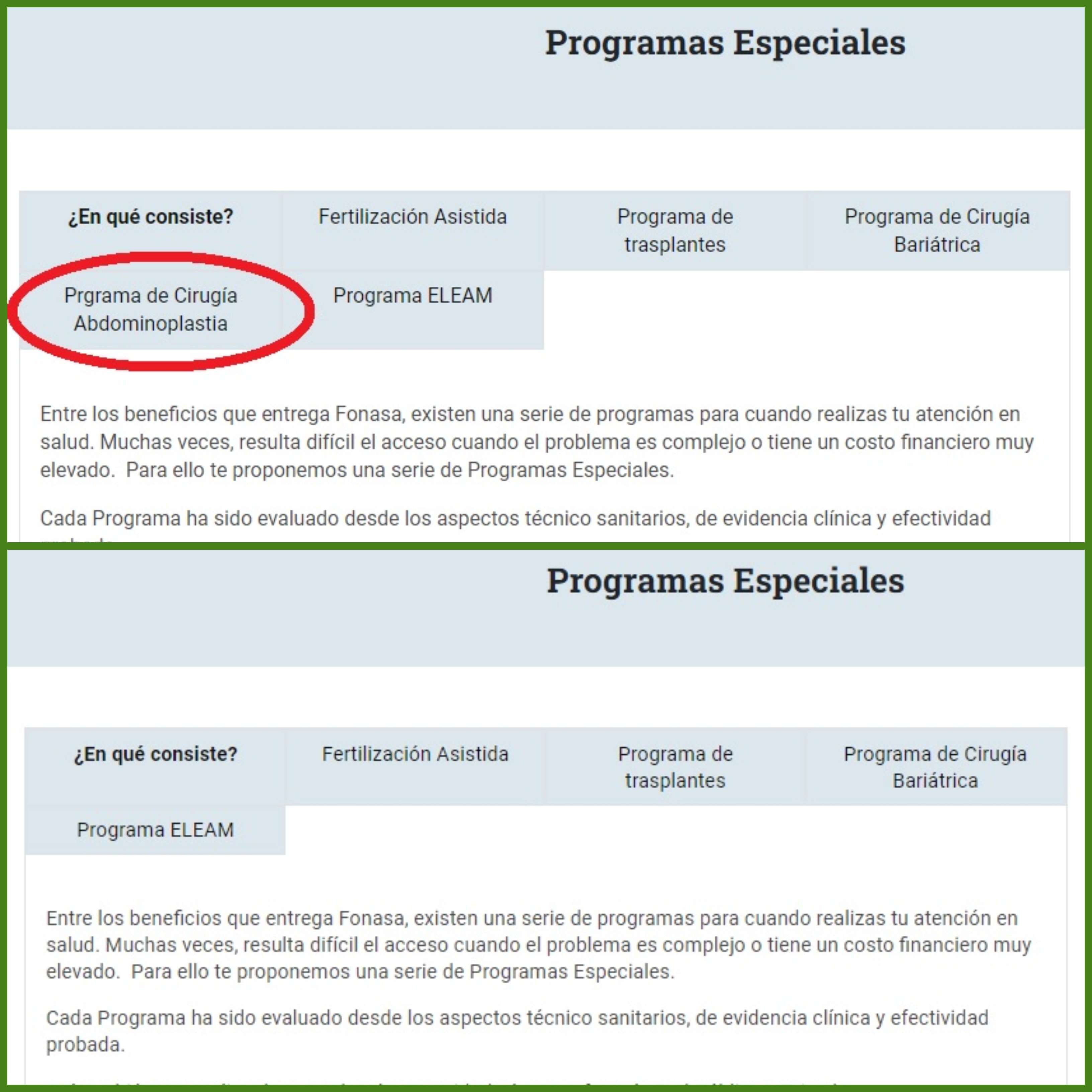 La imagen superior muestra la disponibilidad del Programa de Cirugía Abdominoplastia, mientras que en la inferior no aparece detallado. (Imagen extraída el 5 de enero desde el sitio web de Fonasa)