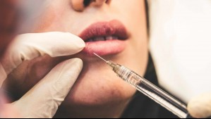 Madre e hija que fingieron ser cirujanas y mataron a una mujer inyectándole silicona son condenadas a 17 años de cárcel