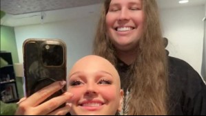 El noble gesto de un hombre con su novia que padece alopecia: Se dejó crecer el cabello para donárselo