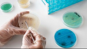 Reportan la primera víctima fatal del virus Alaskapox en Estados Unidos: ¿En qué consiste la enfermedad?