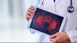 Cáncer de riñón: ¿Cuáles son los principales síntomas de la enfermedad?