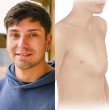 Conoce detalles sobre la cirugía a la que se sometió un joven de Puerto Mont, a quien le corrigieron la condición de pectum carinatum, conocida también como pecho de paloma.