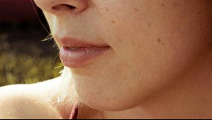 Cinco enfermedades que pueden estar vinculadas a los labios resecos