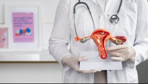 Dos mujeres mueren al día por cáncer cervicouterino en Chile: ¿Cuáles son los síntomas de esta enfermedad?