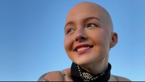 ¿Quién era Maddy Baloy? La joven que compartió su lucha contra el cáncer y que falleció a los 26 años