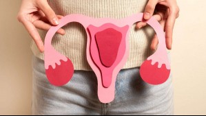 Día Mundial contra el Cáncer de Ovario: ¿Cuáles son los síntomas de la enfermedad?