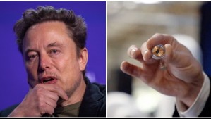 Malas noticias para Elon Musk: Falló el primer implante de chip cerebral realizado por su empresa Neuralink