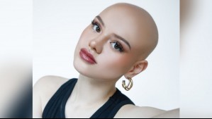 Isidora Carvallo contó cómo sufrir alopecia y diabetes la inspiró a postular al Miss Chile: 'Estoy orgullosa de mí'