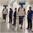 Cristóbal Campos publicó en su Instagram un sorprendente video que muestra su proceso de recuperación tras la amputación de parte de su pierna derecha y en el que se ve cómo quedó tras las diversas operaciones.