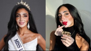 La primera candidata con vitiligo a Miss Universo: Conoce a la Miss Egipto Logina Salah