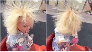 Niña de 2 años se hace viral por tener el llamado 'síndrome del pelo indomable'