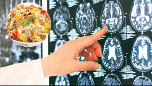 Neurocirujano revela el plato de comida 'ideal' para mejorar la memoria y prevenir la demencia