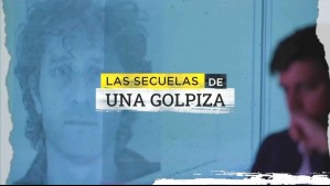 Las secuelas de una golpiza: Habla empresario que persigue sanción para quienes filtraron su ficha médica