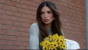 Julia Fernandes muestra la dolorosa quemadura que sufrió en su piel a causa del sol: 'Soy casi un tomate'