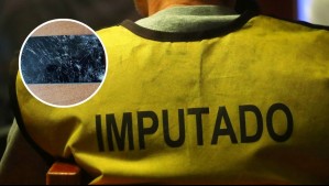 Mujer fue golpeada por un vecino: Quedó con la cara desfigurada y el agresor salió en libertad