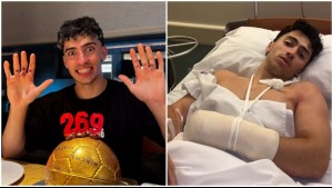 Famoso influencer de desafíos extremos pierde dos dedos de su mano: 'Voy a seguir luchando y se vienen nuevos retos'