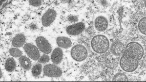 ¿Puede la viruela del mono convertirse en una pandemia? Comunidad científica en alerta por mutación del Mpox