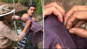 'Tratamos de hacerle el menor daño posible': Pedro Astorga muestra llamativo tratamiento de salud con abejas