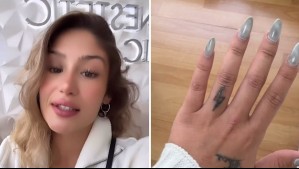 'Cada vez desaparece más': Trini Neira mostró resultados de nueva sesión de borrado de tatuaje