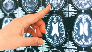 Este simple hábito que hemos ido dejando de lado sería clave para la memoria