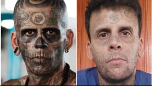 El 'hombre más tatuado de Brasil' decidió borrar los diseños con láser: 'Por más que pongan anestesia, el dolor es horrible'
