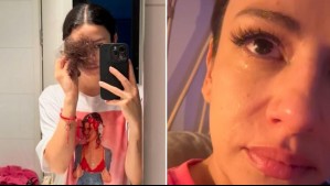 Karla Melo comparte emotiva reflexión en medio de su lucha contra el cáncer: 'Mi enfermedad me transformó'