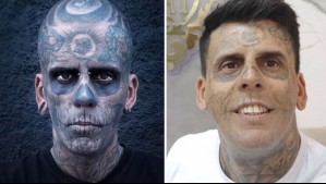'Me sentí como una atracción de circo': El hombre más tatuado de Brasil decidió borrar los diseños con tratamiento láser