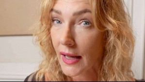 'Una imagen vale más que mil palabras': Cata Pulido muestra resultado de intervención estética en su rostro