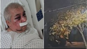 Cámara de seguridad capta brutal agresión a conserje de 70 años en Vitacura