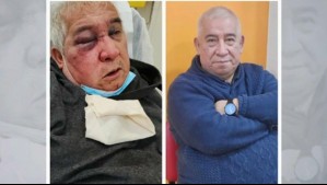 Agresor tenía 5 detenciones anteriores: Esto es lo que se sabe del ataque sufrido por el conserje de 71 años