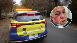 Víctima podría perder un ojo: Empresario que agredió a conserje de 70 años en Vitacura quedó en libertad tras formalización